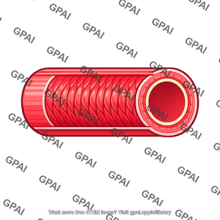 Muscular artery