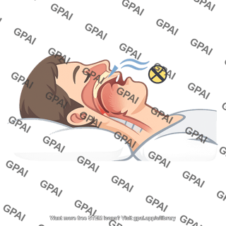 Sleep apnea