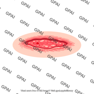 Wound