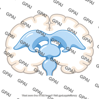 Brain ventricle enlarged