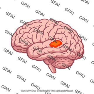 Brain with damaged area