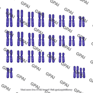 Down syndrome karyotype 21 trisomy