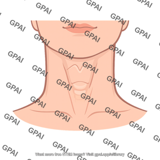 Throat exterior
