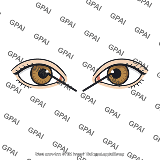 Eyes converged