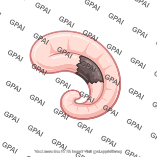 Hippocampus damaged