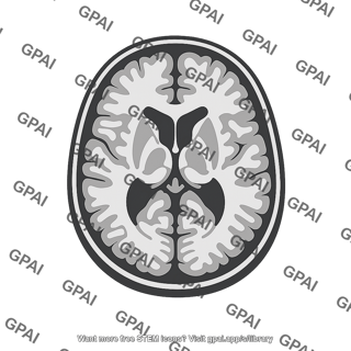 Mri brain scan