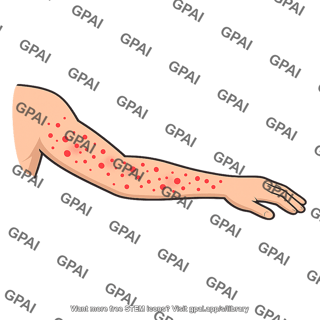 Arm with rash