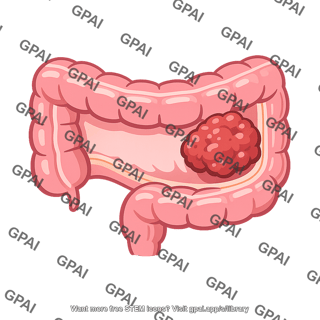 Colon tumor