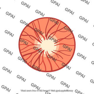 Optic disk