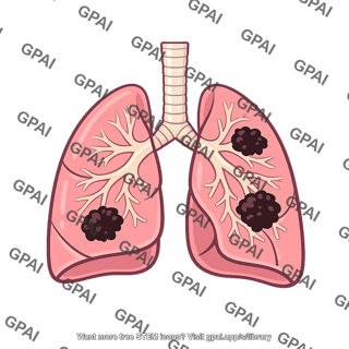 Lung cancer