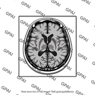 Brain mri scan