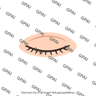 Eye closed