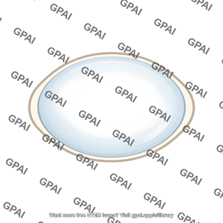 Lens opaque