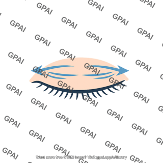 Rapid eye movement eye