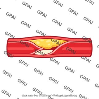 Coronary artery blocked