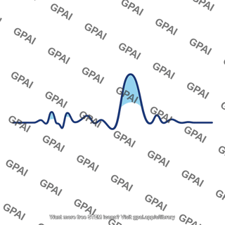 P3 waveform