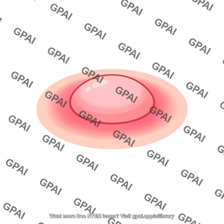 Immune response induration