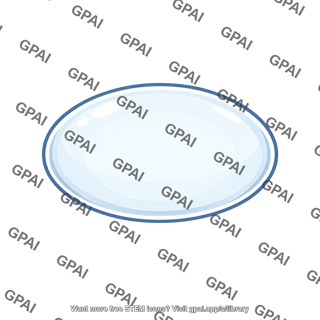 Eye lens